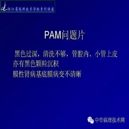 肾穿活检组织特殊染色方法