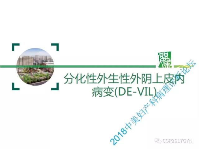 非HPV相关的外阴鳞状细胞肿瘤