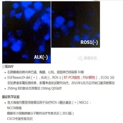 中日韩个体化诊疗案例大赛经典赏析之十——驱动基因双突变，两种靶向药物均无效，个体化治疗的阿克琉斯之踵