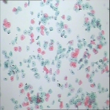 默认相册