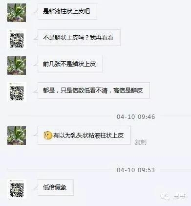 阴道鳞状上皮乳头状瘤？尖锐湿疣？（孔祥田老师病例分享，粉蓝医疗科技（杭州）有限公司女性生殖2群讨论，孔祥田(Max)*Roswell*老师讲解）