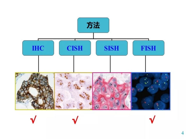 乳腺癌HER2检测指南更新