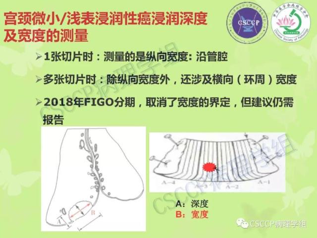 宫颈与子宫病变病理标本取材