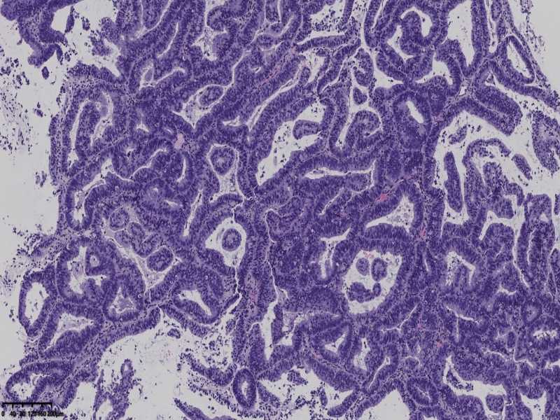 如何消除切片中的裂隙