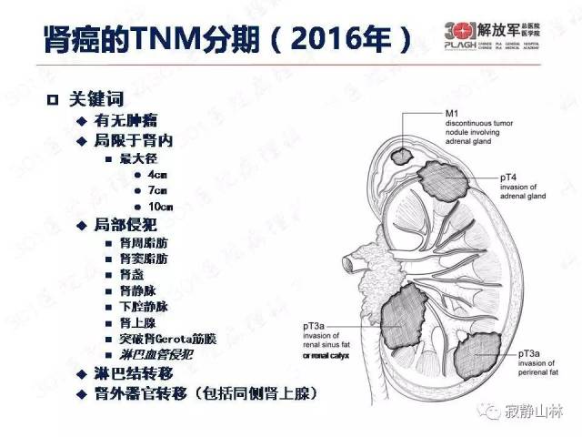 泌尿系统常见肿瘤标本病理报告规范