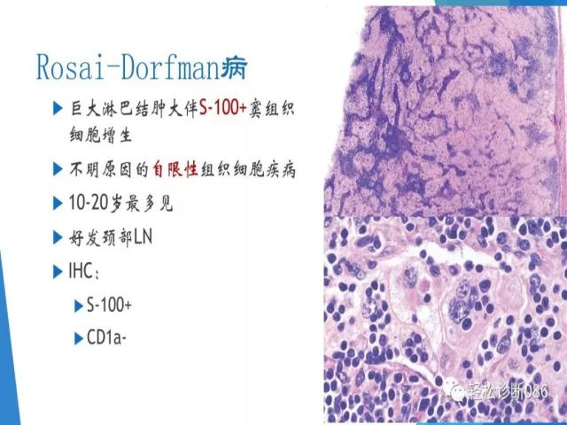 组织细胞来源疾病