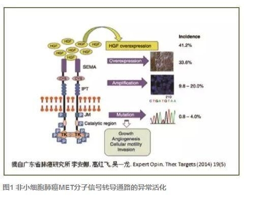 原发MET基因扩增型肿瘤“METoma”与精准医学
