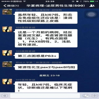 High grade nested variant Urothelial carcinoma(老胡分享，孔祥田老师讲解)