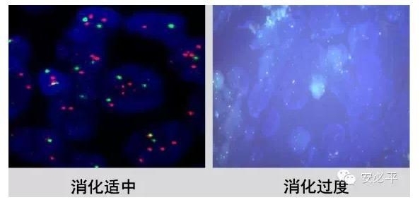 荧光原位杂交(FISH)样本处理标准方案系列(一)——常规石蜡包埋组织切片
