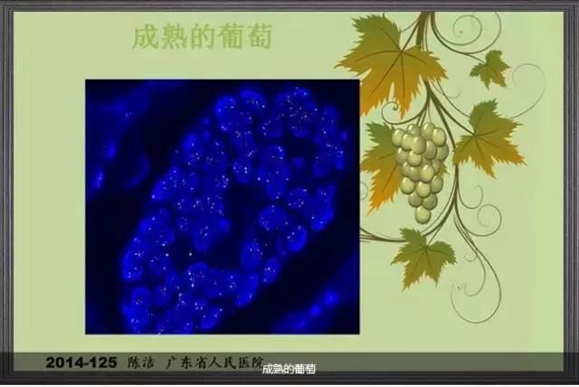 你见过这么美的病理切片吗？