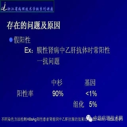 探讨免疫组织学在肾穿标本中的应用