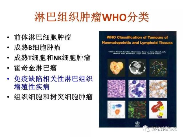 免疫缺陷相关淋巴组织增殖性疾病