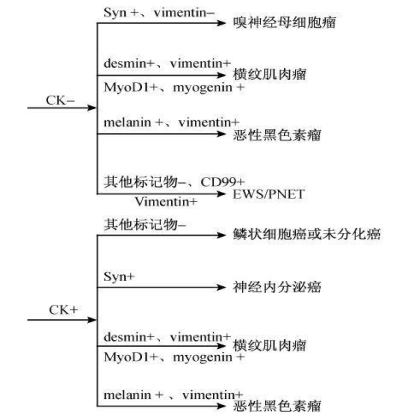 鼻腔鼻窦小圆细胞恶性肿瘤免疫组化诊断示意图