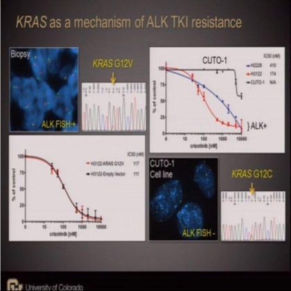 Analysis of resistance mechanisms to ALK kinase inhibitors in ALK+ NSCLC patients