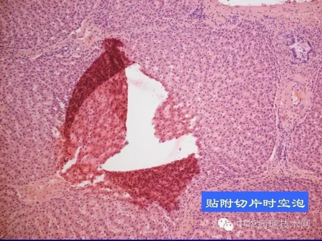 影响冰冻切片质量的原因（比赛注意事项）