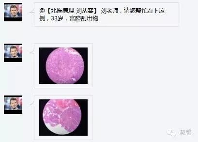高分化子宫内膜样癌与分泌期子宫内膜、黏液腺癌的鉴别（孔令英分享，刘从容老师讲解）