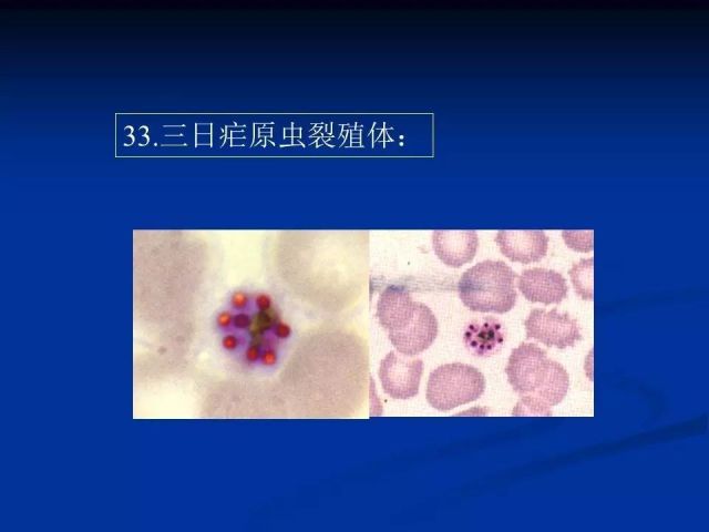 收藏！寄生虫图谱大全