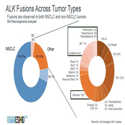 Genomic profiling of 114,200 advanced cancers identifies recurrent kinase domain duplications (KDD)