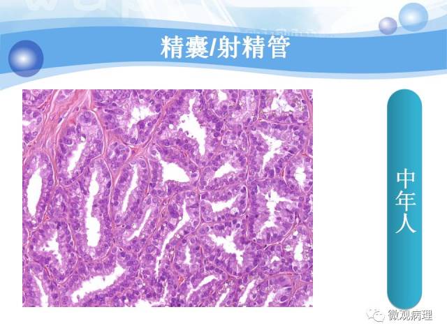 正常前列腺组织学