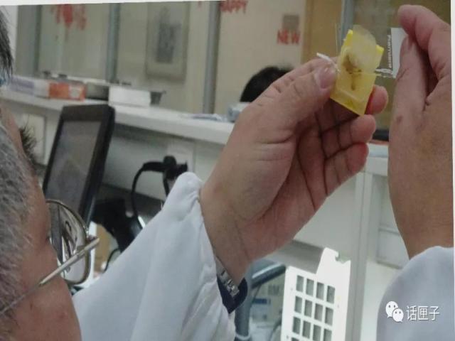 肿瘤还是囊肿?恶性还是良性?他们说了算!这群“幕后高手”,你未必了解…… 肿瘤还是囊肿?恶性还是良性?他们说了算!这群“幕后高手”,你未必了解……