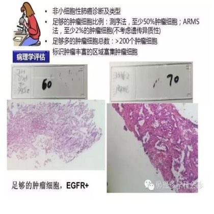 EGFR基因突变检测--基础篇