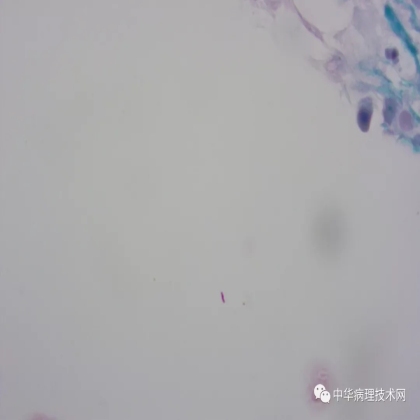 如何避免抗酸染色假阳性