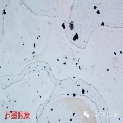 免疫组化结果的分析和常见问题的处理