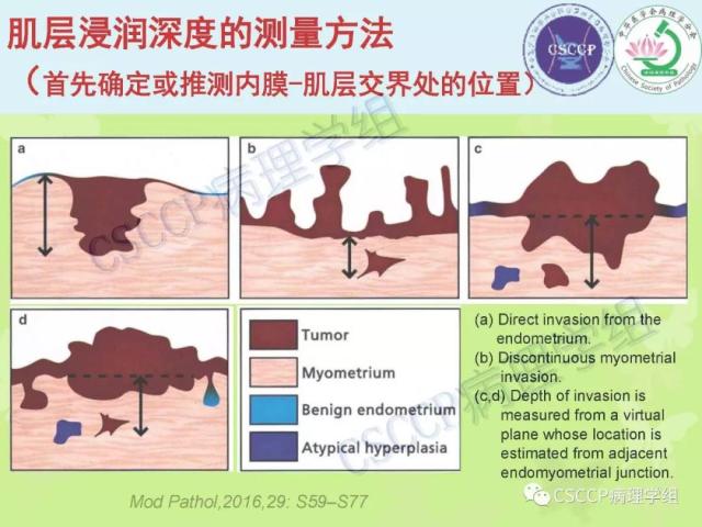 宫颈与子宫病变病理标本取材