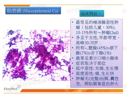 “黏液表皮样癌”答网友问---文献复习：儿童涎腺肿瘤