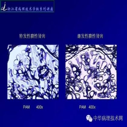 肾穿活检组织特殊染色方法