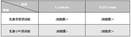 乳腺导管浸润癌和乳腺小叶浸润癌的免疫表型区分