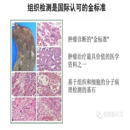 肿瘤精确医疗与分子病理检测