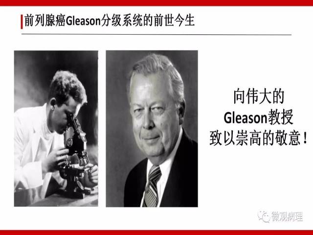 前列腺癌Gleason分级系统的前世今生