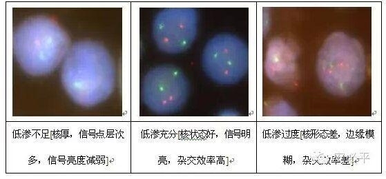 荧光原位杂交(FISH)样本处理标准方案系列(二)——常规细胞学样本