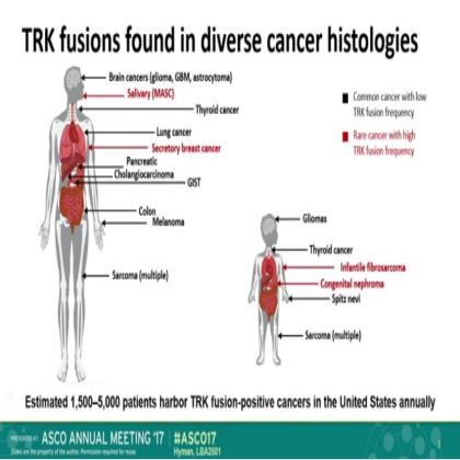 The efficacy of LOXO-101,a selective TRKI, in adult and pediatric TRK fusion cancers