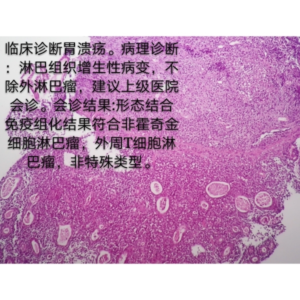 病理科工作札记（四十）举例细说四类病理诊断