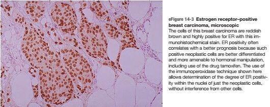 Robbins and Cotran Atlas of Pathology (2015第3版) 英语原版