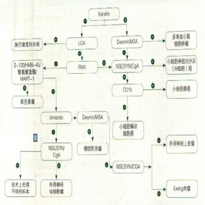 恶性小圆细胞肿瘤免疫组化标记物诊断示意图