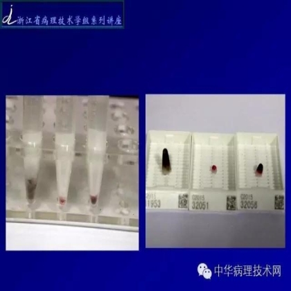 细胞蜡块的制作