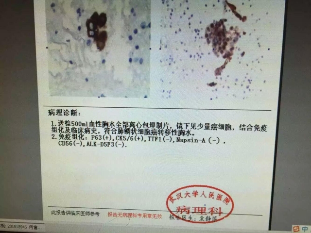 病理科新技术(一)：细胞蜡块