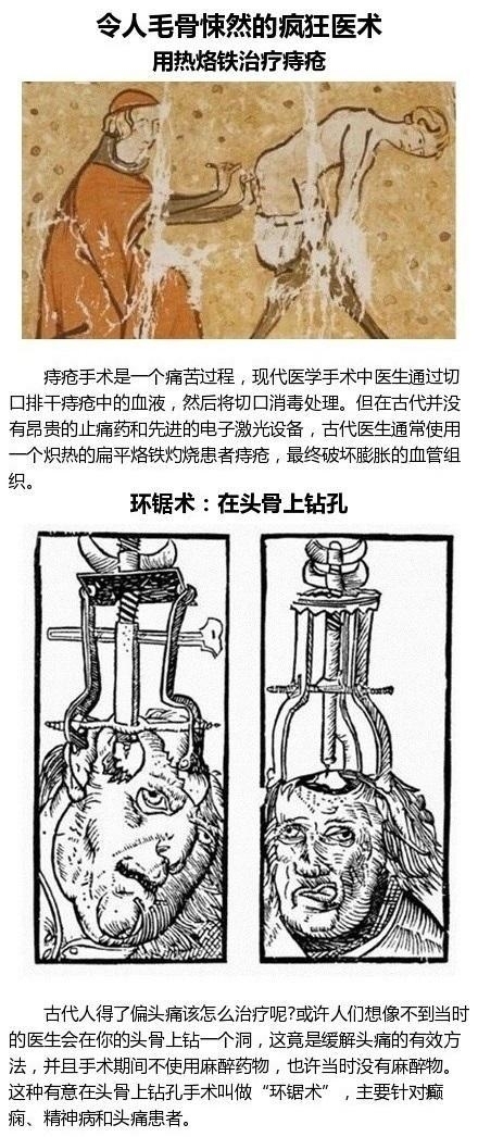 古代令人意想不到的治疗方式 你不能错过哟！