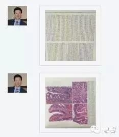 结、直肠管绒毛状腺瘤-高级别病变诊断等相关问题2（悄悄分享、孔祥田(Max)*Roswell*老师讲解）
