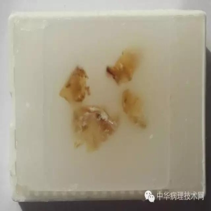 介绍几种日常工作中常见组织的脱钙方法