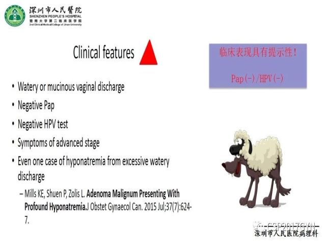 2019USCAP妇科病理热点介绍