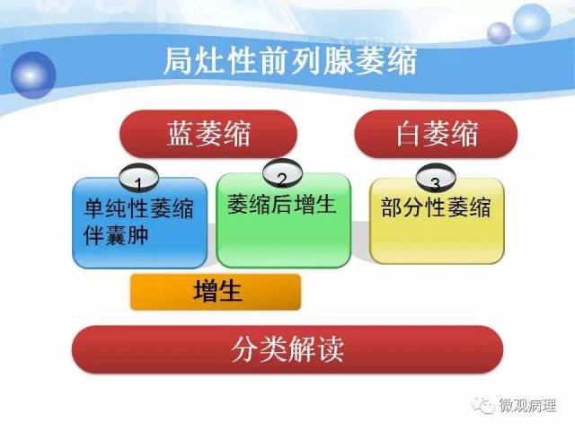 泌尿课程/局灶性前列腺萎缩