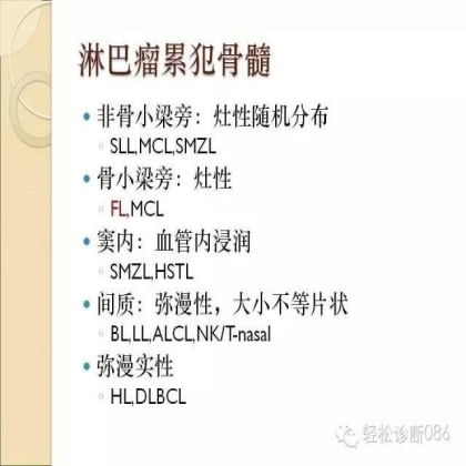 滤泡性淋巴瘤