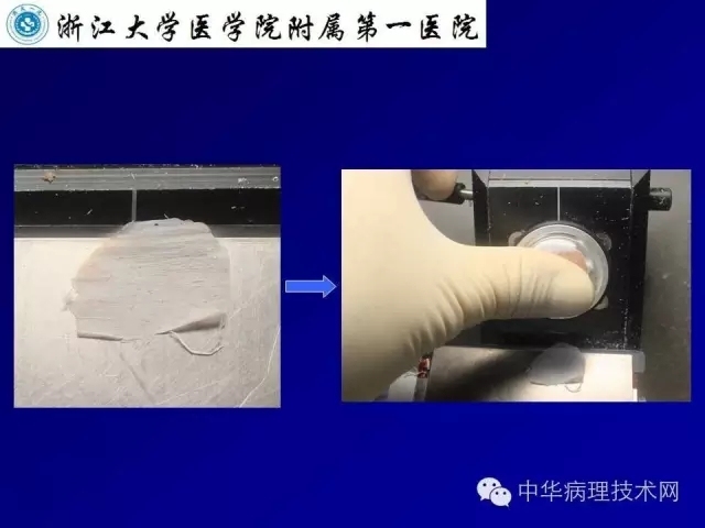 冰冻切片报告注意事项