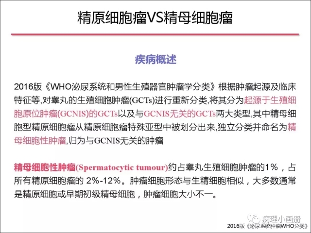 泌尿病理--精原细胞瘤VS精母细胞瘤