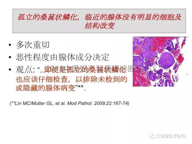 子宫内膜假肿瘤性病变及类似癌样病变