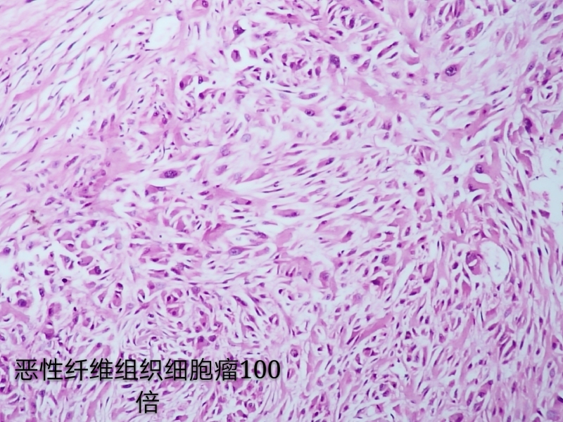病理科工作札记（三十六）如何用手机拍出满意的组织学照片